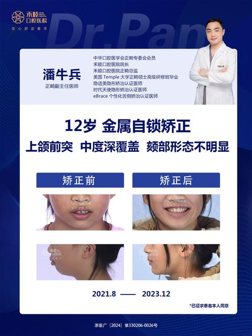 错合畸形的治疗方法有哪些?如何根据畸形类型选择?-图1 错合畸形的治疗方法有哪些?如何根据畸形类型选择?-图1