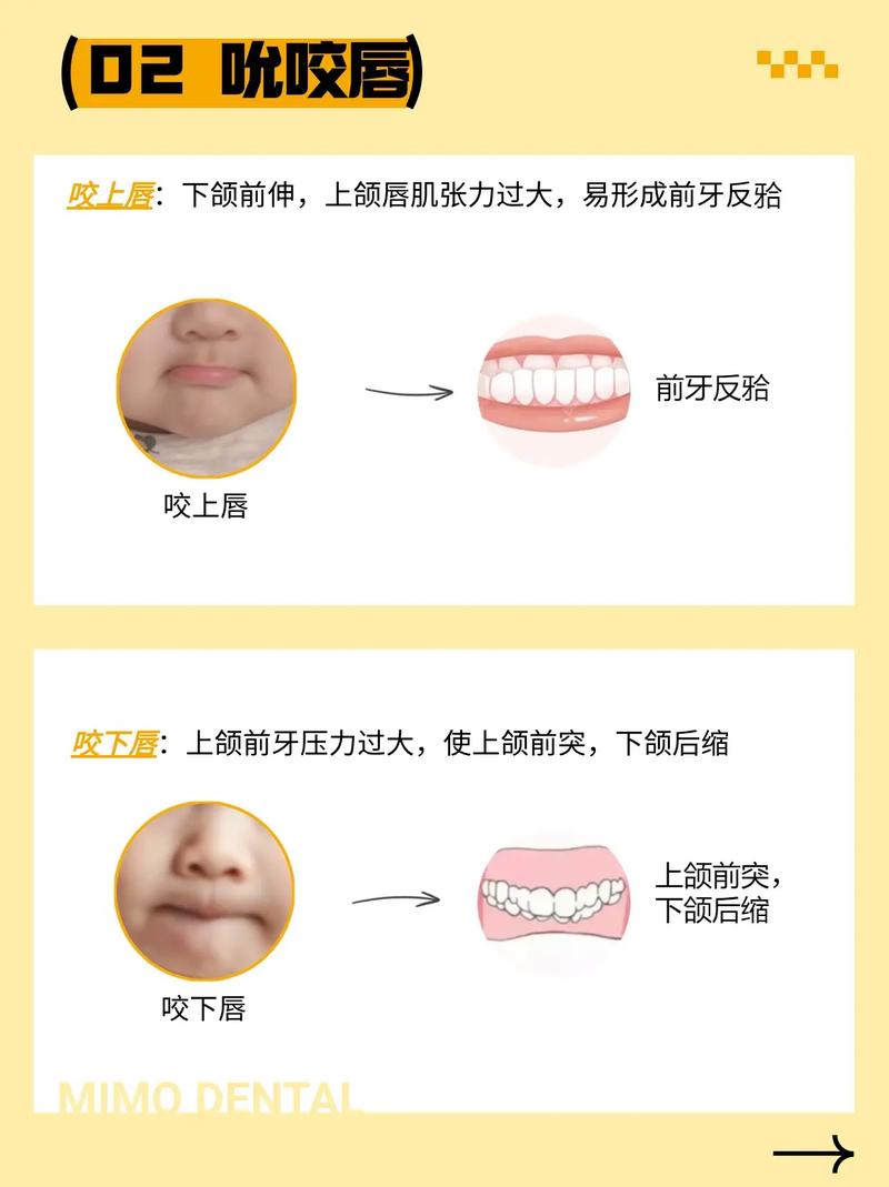 错合畸形的治疗方法有哪些？如何根据畸形类型选择？-图2
