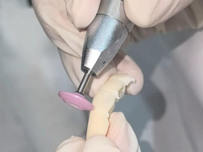 临时牙制作方法图片-图1 临时牙制作方法图片-图1