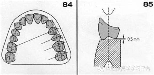 全口牙排牙方法图例，如何通过图例掌握排牙的正确步骤与技巧？-图3