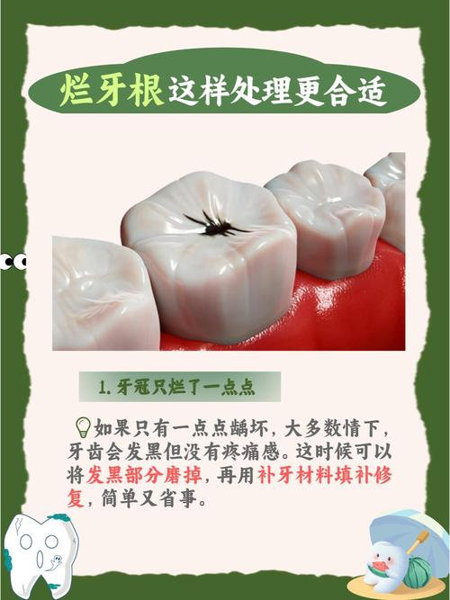 根龋齿怎么治疗方法-图2 根龋齿怎么治疗方法-图2