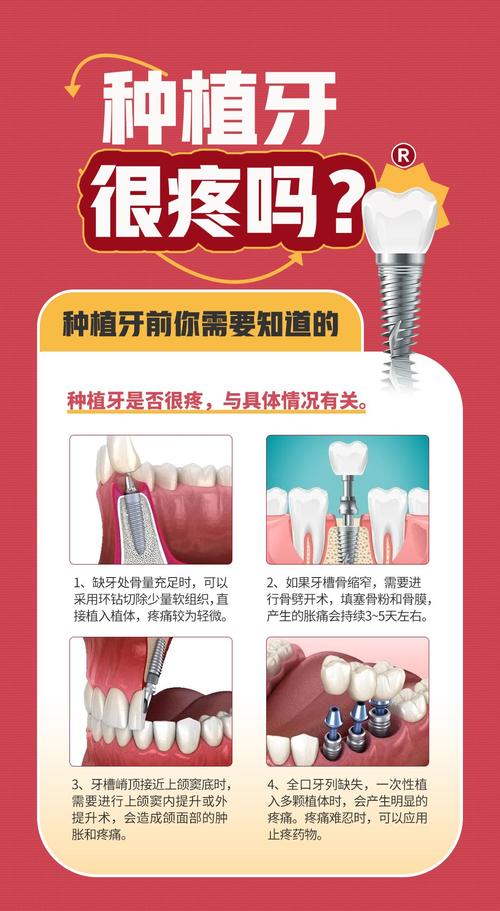 种牙跟拔牙比,哪个手术的疼痛程度更高?-图1 种牙跟拔牙比,哪个手术的疼痛程度更高?-图1