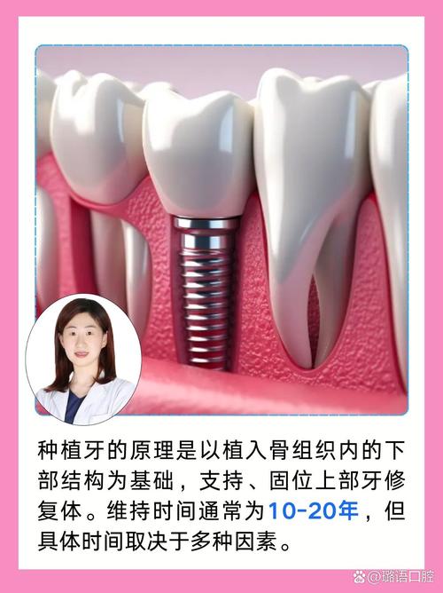 山西大医院能种牙吗?种植牙服务及注意事项有哪些?-图3 山西大医院能种牙吗?种植牙服务及注意事项有哪些?-图3