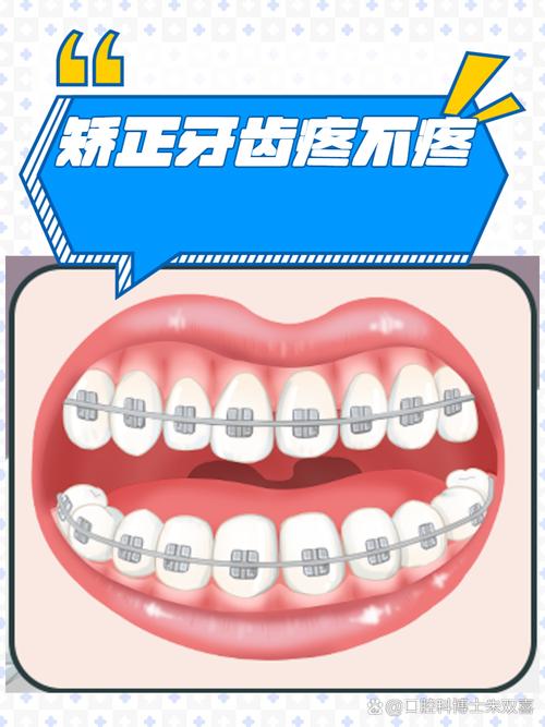 牙缝矫正最简单方法是什么?哪种方式更省时省力又安全有效吗?-图2 牙缝矫正最简单方法是什么?哪种方式更省时省力又安全有效吗?-图2