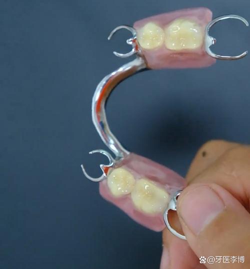 可摘义齿上颌架方法-图2 可摘义齿上颌架方法-图2