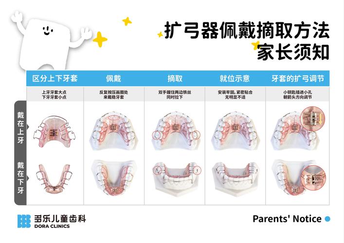 活动扩弓器加力方法有哪些关键操作步骤？-图1