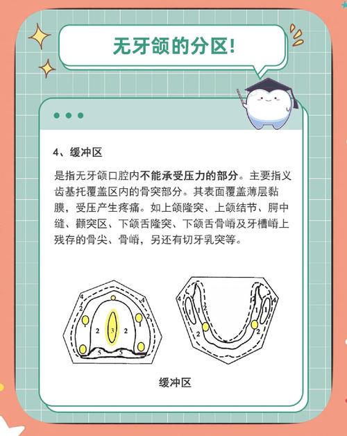 如何有效减少义齿颌力？实用方法有哪些？-图2