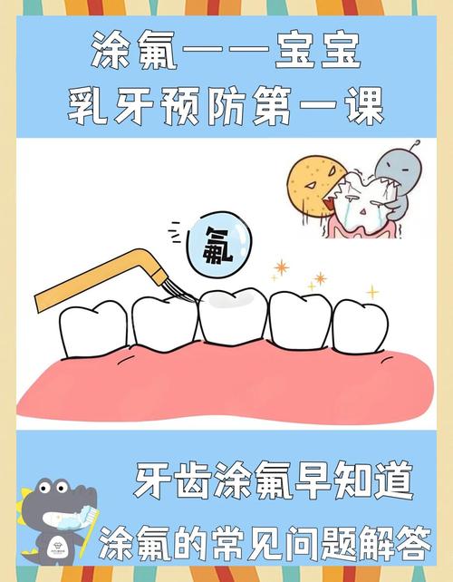 乳牙氟泡沫正确使用方法是什么？家长需掌握哪些操作步骤？-图2