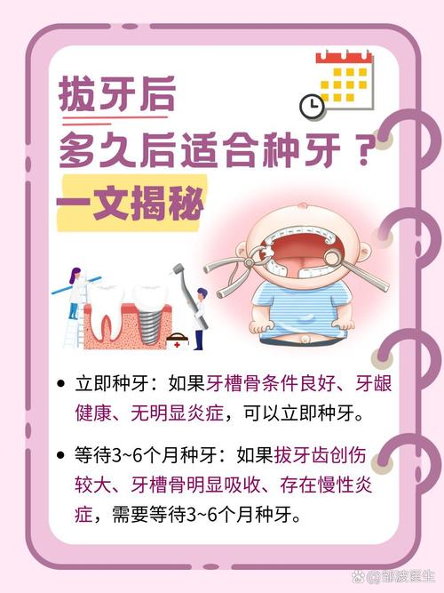 拔牙种牙流程要多久-图1 拔牙种牙流程要多久-图1