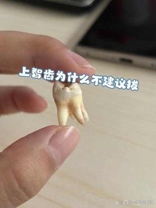 智齿弯根拔出难不难？具体方法和步骤是怎样的？-图3