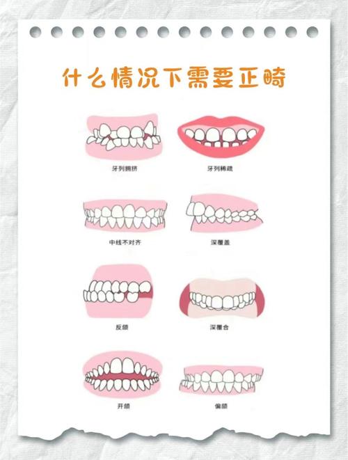 数字化正畸技术有哪些不容忽视的缺点?-图1 数字化正畸技术有哪些不容忽视的缺点?-图1