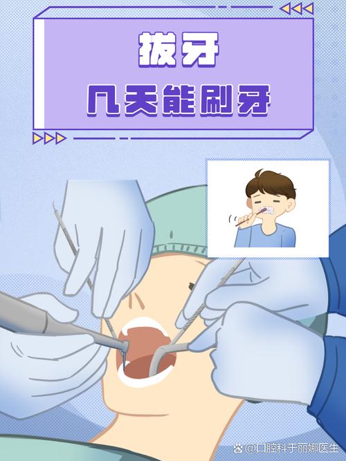 牙科粘骨牙拔除方法有哪些?难点与操作技巧是什么?-图3 牙科粘骨牙拔除方法有哪些?难点与操作技巧是什么?-图3