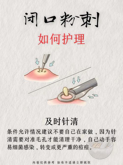 闭口式印模制取方法-图3