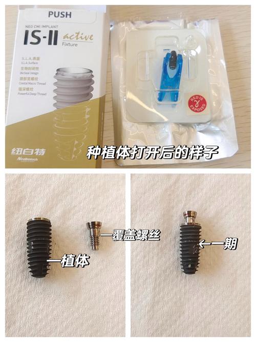 判断种植钉松动方法-图1 判断种植钉松动方法-图1