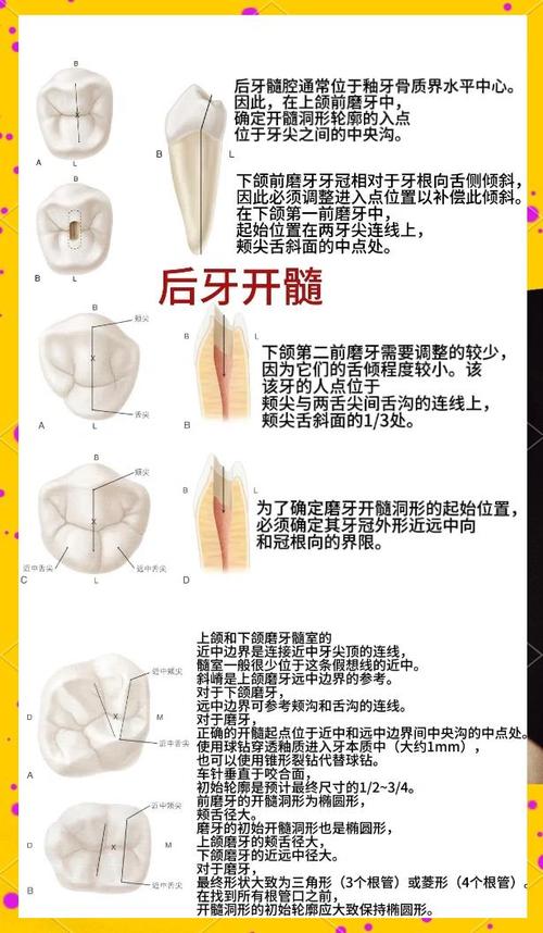 上颌窦底穿处理方法-图2