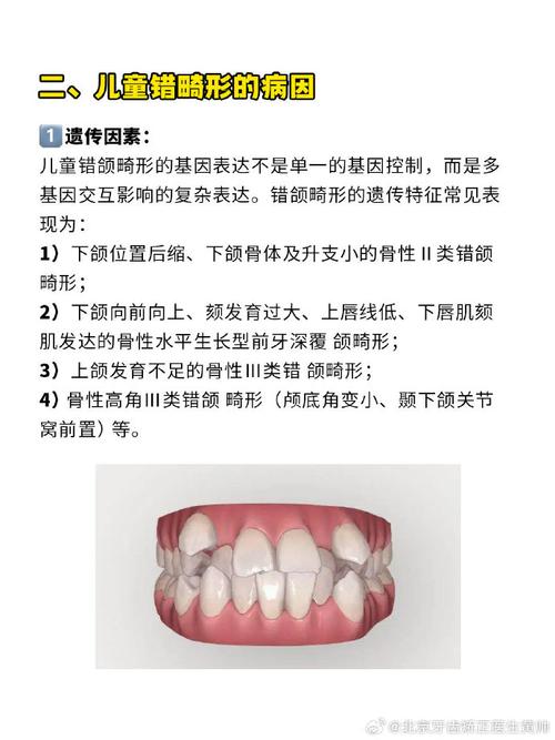 错合畸形分类方法有哪些？主要类型及划分依据是什么？-图3