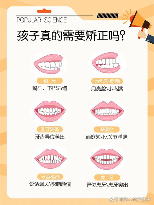 正畸牙齿能上下移动吗？方向控制有难度吗？-图3