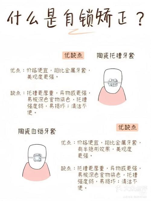 自锁托槽的安装方法-图2