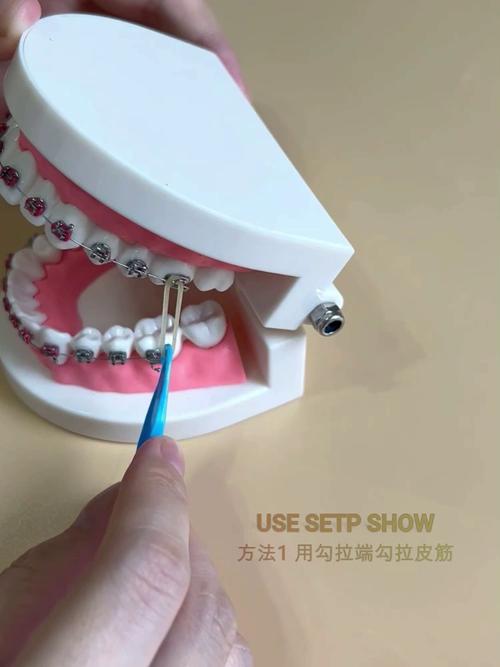 正畸牵引橡皮圈哪里能买到?-图1 正畸牵引橡皮圈哪里能买到?-图1