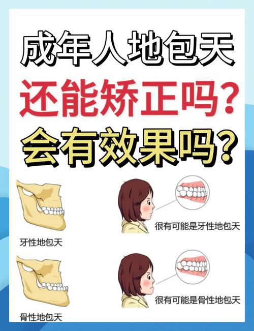 成年地包天有哪些有效纠正方法?-图1 成年地包天有哪些有效纠正方法?-图1