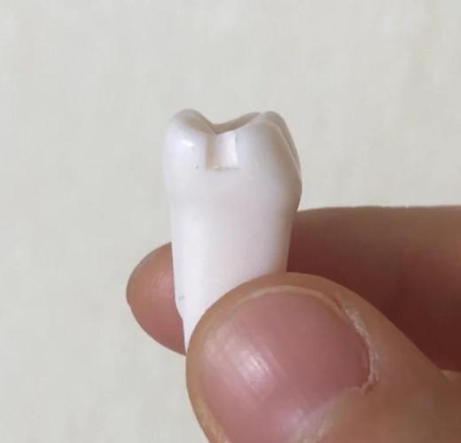 填牙齿洞用什么方法-图2 填牙齿洞用什么方法-图2