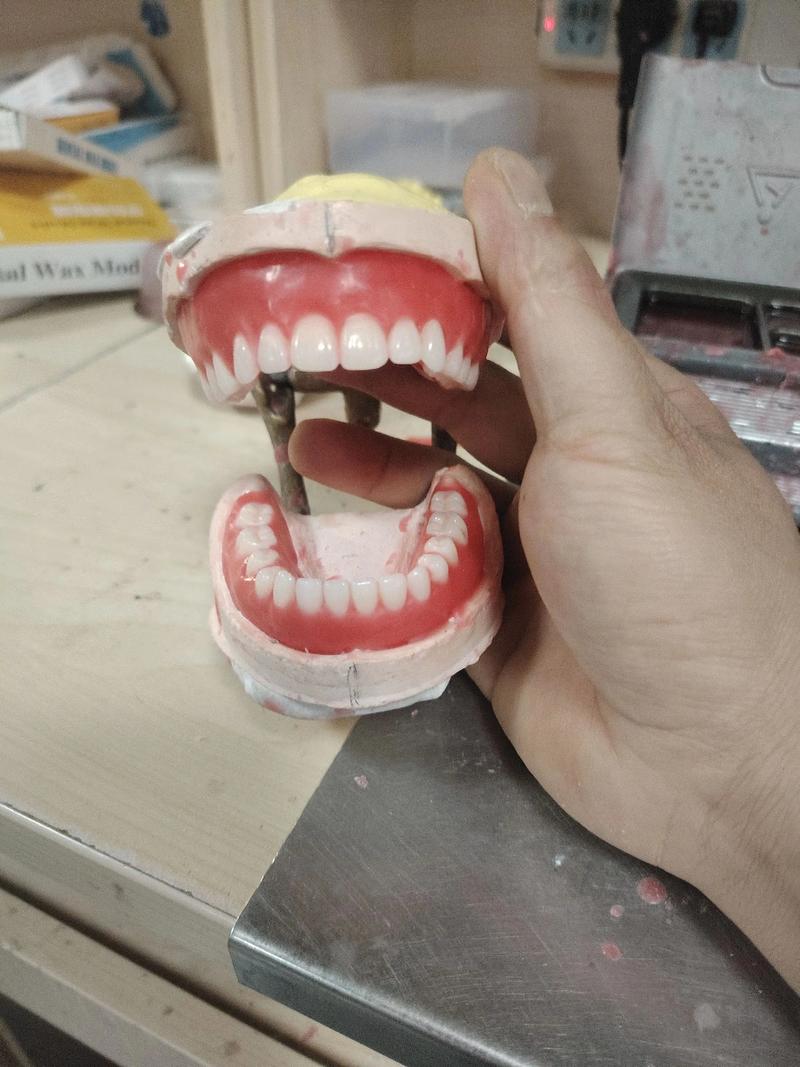 树脂假牙制作方法的具体步骤和所需材料有哪些？-图2