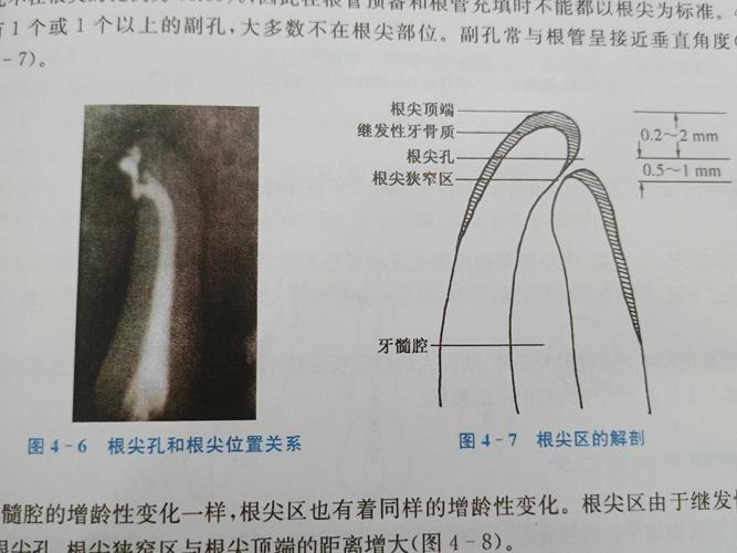 临床中探究根管形态的有效方法有哪些常用技术手段?-图3 临床中探究根管形态的有效方法有哪些常用技术手段?-图3