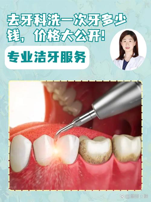 口腔超声波洁牙方法怎么做？过程安全吗？-图3