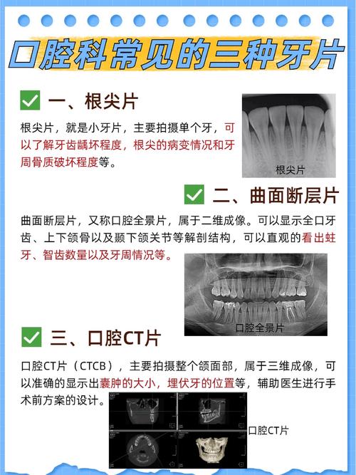 上海口腔正畸必须拍片吗?-图1 上海口腔正畸必须拍片吗?-图1