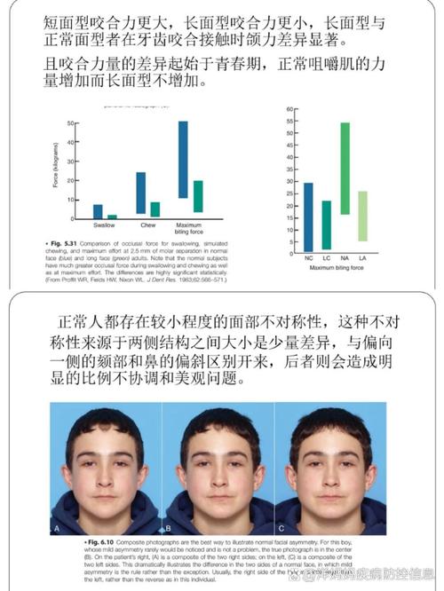 正畸拔牙会导致脸塌吗？-图1