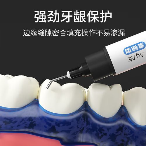 牙科像屏障的使用方法是什么?具体操作步骤有哪些?-图1 牙科像屏障的使用方法是什么?具体操作步骤有哪些?-图1