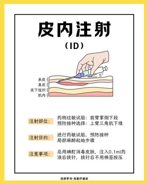 碧兰麻无痛注射方法-图3