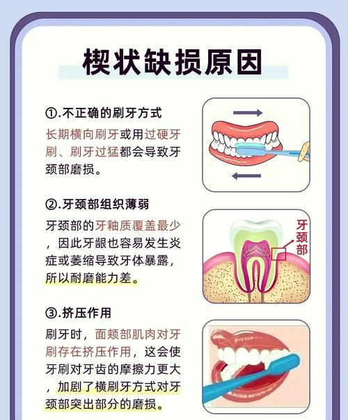 牙列缺损修复方法优缺点如何？怎样选最适方案？-图1