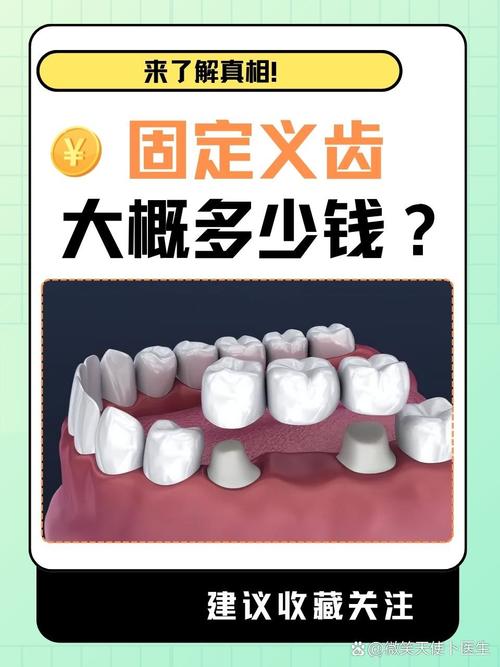 固定义齿如何正确清洁？日常护理方法有哪些？-图3