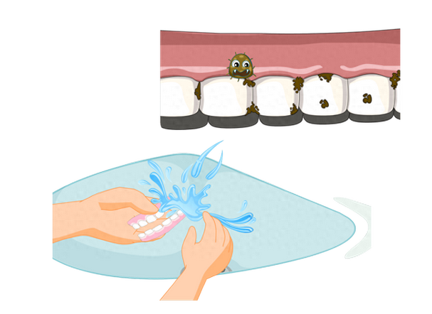 固定义齿如何正确清洁？日常护理方法有哪些？-图1