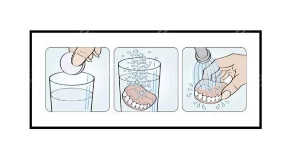 固定义齿如何正确清洁？日常护理方法有哪些？-图2