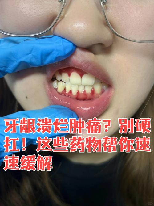 种牙麻药过后疼不疼-图1 种牙麻药过后疼不疼-图1