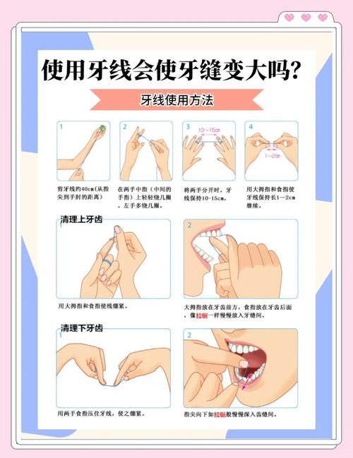 如何掌握橡皮障牙线打结方法？具体步骤与技巧有哪些？-图3