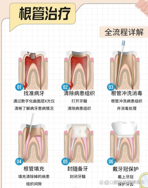蛀牙土方法治疗有效吗？民间偏方真的能解决蛀牙问题吗？-图2