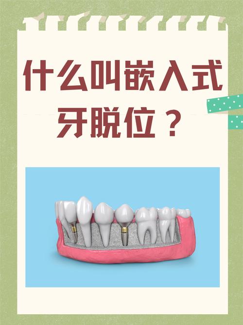 牙较脱位如何正确处理?应急措施与就医步骤有哪些?-图2 牙较脱位如何正确处理?应急措施与就医步骤有哪些?-图2