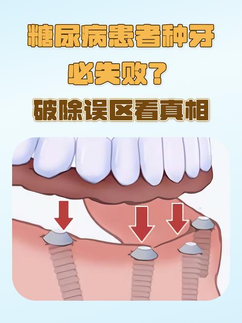 种牙失败具体有哪几种常见情况呢？-图3