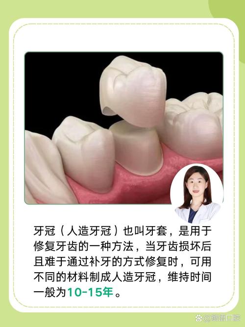 种牙后多久能上牙冠？恢复时间因人而异吗？-图1