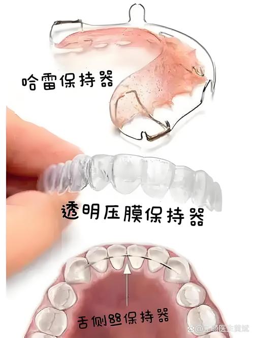正畸推磨牙前移8mm可行吗?效果与风险如何?-图3 正畸推磨牙前移8mm可行吗?效果与风险如何?-图3