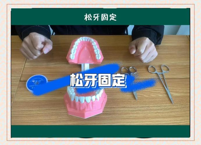 牙齿根折后如何选择固定方法?-图1 牙齿根折后如何选择固定方法?-图1