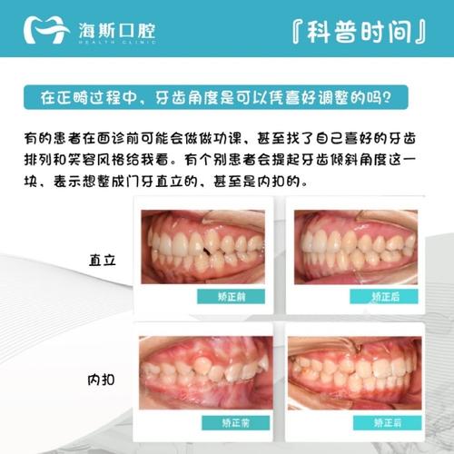 牙槽骨吸收了还能正畸吗？矫正过程有哪些注意事项？-图3