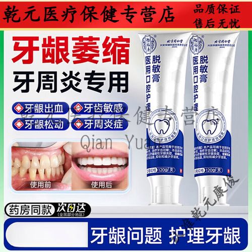 牙科脱敏剂如何正确使用?步骤及注意事项有哪些?-图1 牙科脱敏剂如何正确使用?步骤及注意事项有哪些?-图1