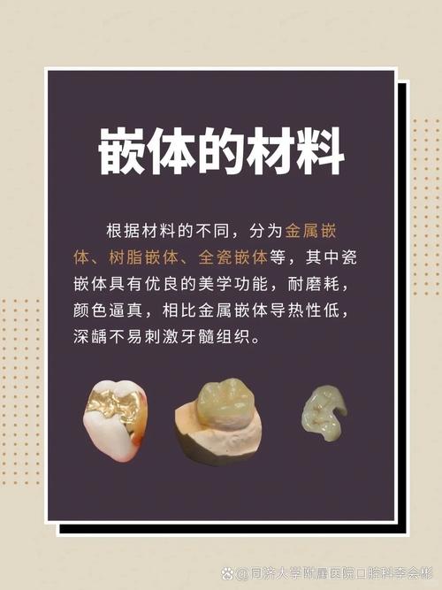 牙体充填术补牙方法-图2