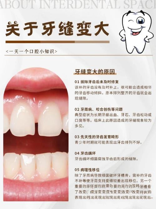 门牙缝隙如何修复?有哪些常用且靠谱的方法?-图1 门牙缝隙如何修复?有哪些常用且靠谱的方法?-图1