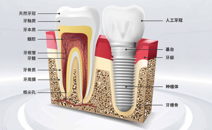 同济口腔为何将种牙设分部?分部种牙有何优势?-图3 同济口腔为何将种牙设分部?分部种牙有何优势?-图3