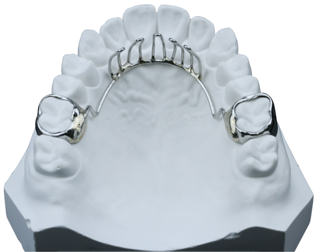 正畸弓丝自带停止扣有何优势?能否提升矫治精准度?-图1 正畸弓丝自带停止扣有何优势?能否提升矫治精准度?-图1
